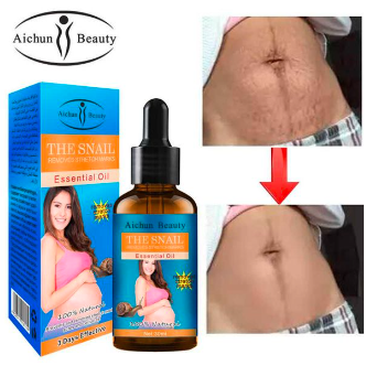 REMOVES STRETCH MARKS