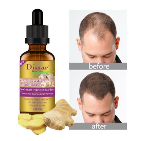 HAIR ESSENTIAL OIL ANTI-HAIR LOSS